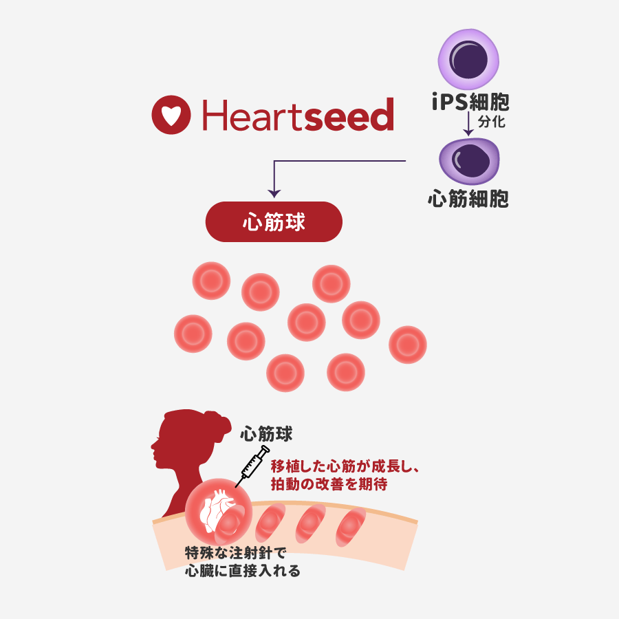 リードパイプライン